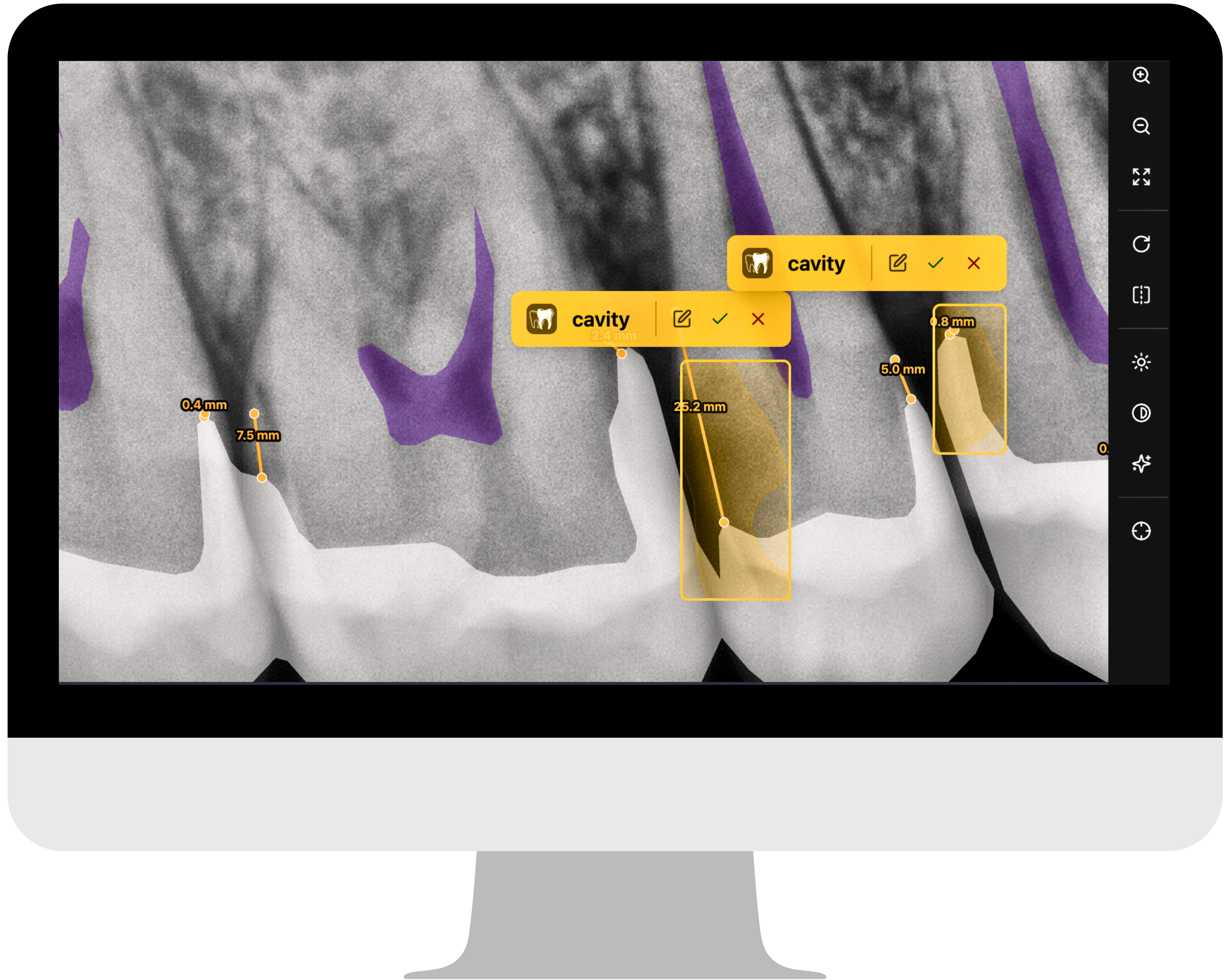 Dental Features